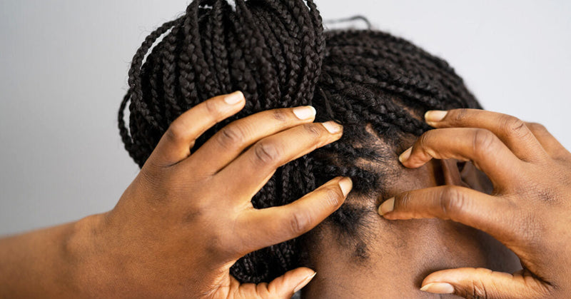 HITS Beauty Brand Peachy Peppermint " SCALP CALMER "